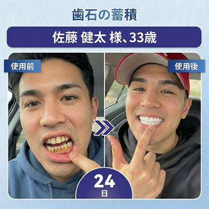 🇯🇵🦷知覚過敏・歯ぐきの不快感をしっかりケア！ 𝐂𝐨𝐚𝐮𝐨𝐨® タイドグルシブ配合オーラルストリップが登場。 歯と歯ぐきを優しく速やかに整え、貼るだけ簡単ケア。 毎日の口内ケアを無理なくグレードアップ✨