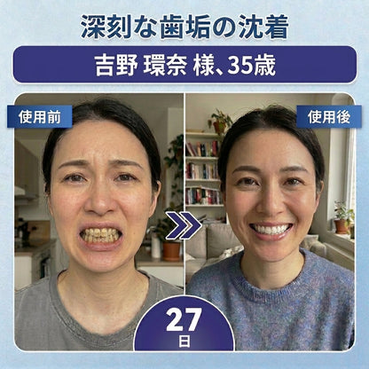 🇯🇵🦷知覚過敏・歯ぐきの不快感をしっかりケア！ 𝐂𝐨𝐚𝐮𝐨𝐨® タイドグルシブ配合オーラルストリップが登場。 歯と歯ぐきを優しく速やかに整え、貼るだけ簡単ケア。 毎日の口内ケアを無理なくグレードアップ✨